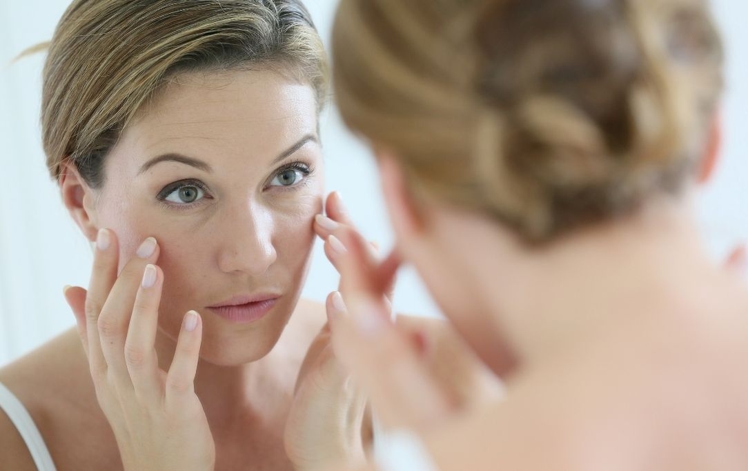 Cause acne tardiva: come puoi rimediare? Segui una corretta skin care unita ad una dieta sana