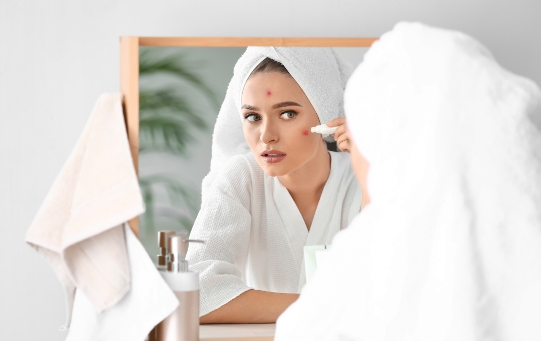 Skincare per pelle acneica: affidati alla giusta cosmesi
