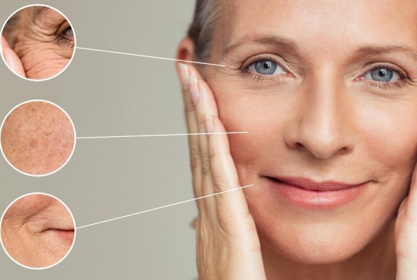 12 consigli su come prevenire l'invecchiamento della pelle