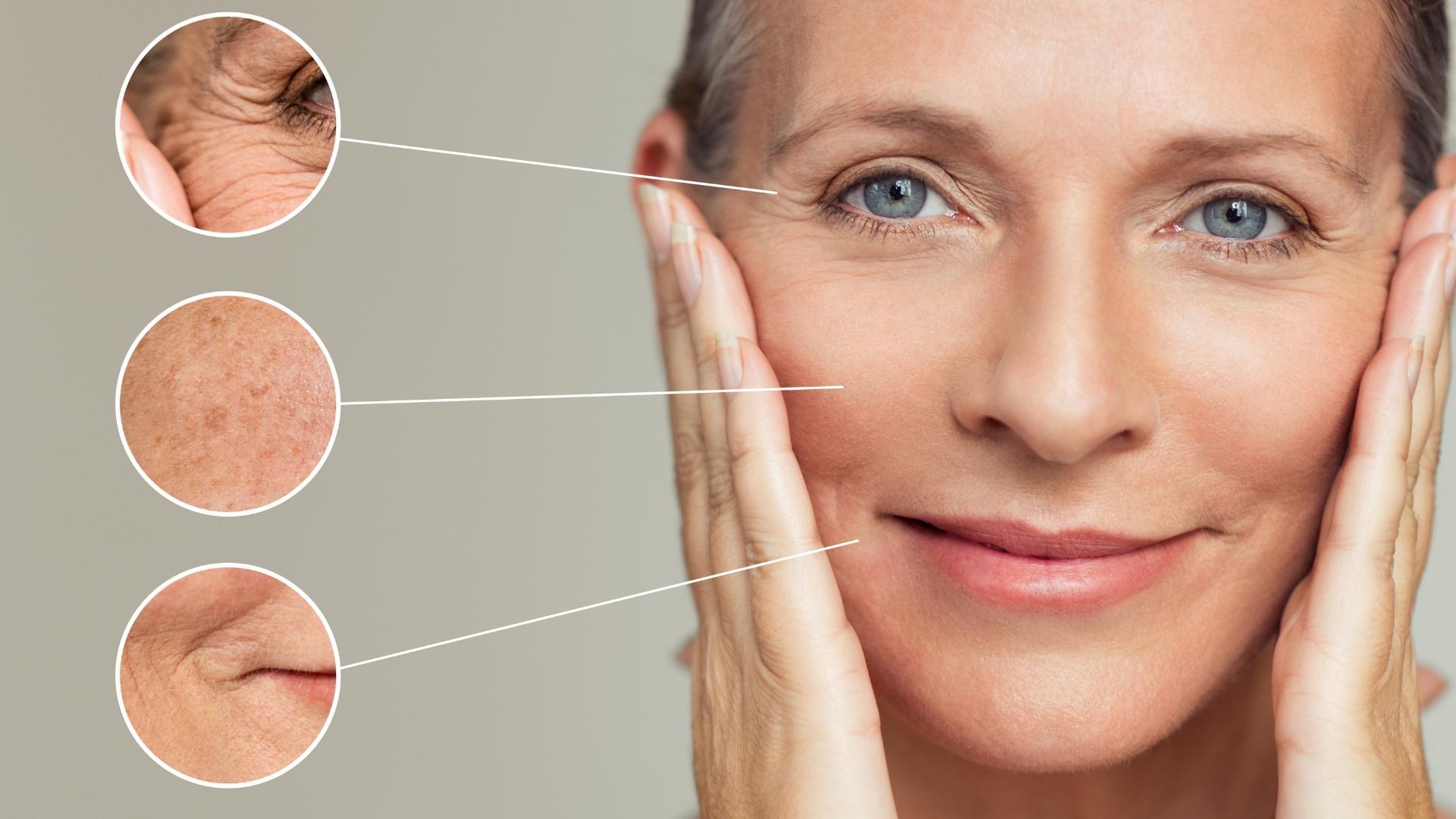 Come prevenire l’invecchiamento della pelle? 12 consigli della dottoressa della pelle