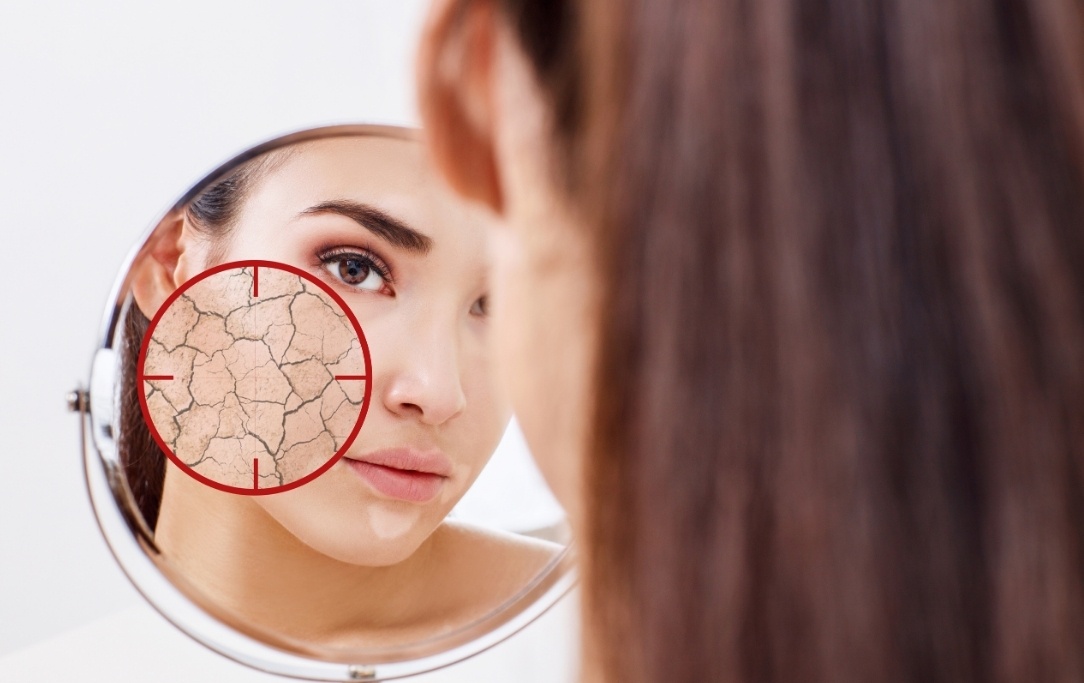 Pelle secca: come prevenire l'invecchiamento della pelle